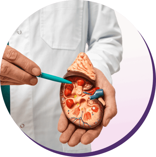 A physician in a white coat using a model of a kidney to show where kidney stones can appear