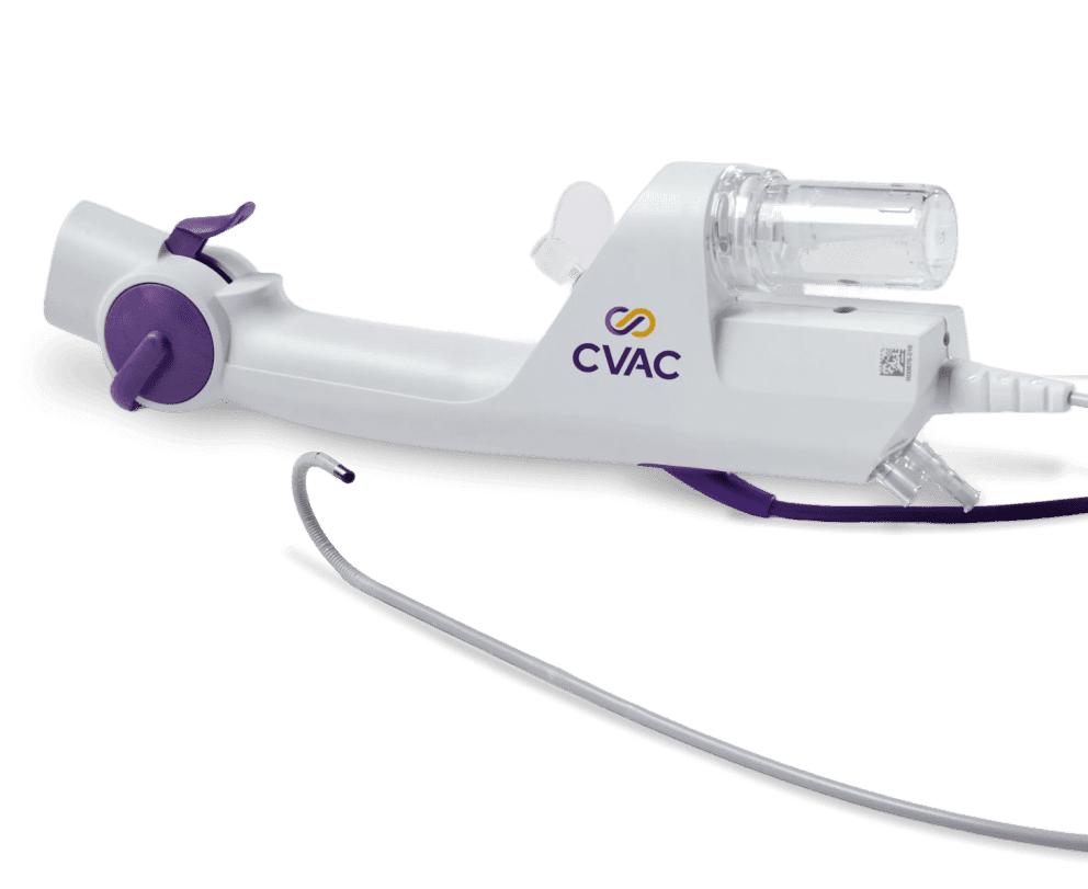A picture of the handpiece for the CVAC System kidney stone treatment